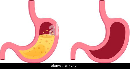Gerd Magen-Ikone im flachen Stil. Abbildung des Refluxvektors auf isoliertem Hintergrund. Oesophagusorganzeichen-Geschäftskonzept. Stock Vektor