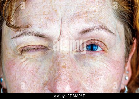 Nahaufnahme eines Porträts einer älteren Frau mit einem geschlossenen und einem blauen Auge, das natürliche Hautstruktur und Sommersprossen zeigt. Stockfoto