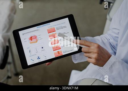 Kaukasische Ärztin Erklärt Melanomstadien Mit Digital Tablet Stockfoto