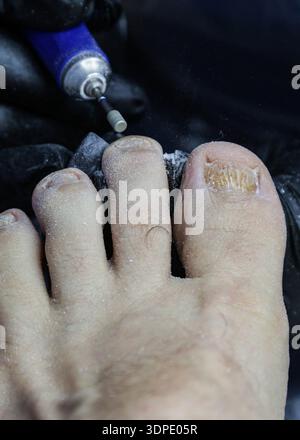 Die Zehennägel eines Mannes werden abgefeilt. Eine Nahaufnahme der Hände eines Podologen in schwarzen Handschuhen, die seine Zehennägel mit einer Nagelfeile feilen. Pedikürsalon. Stockfoto