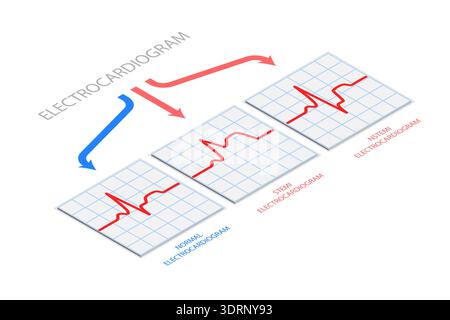 Isometrische 3D-Illustration von Elektrokardiogramm, Diagnostik und Gesundheitswesen Stockfoto