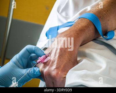 Platzierung einer intravenösen Durchstechflasche (periphere Venenkatheterisierung), Son Llatzer Hospital, Mallorca, Balearen, Spanien Stockfoto
