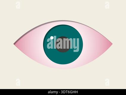 Illustration der Konjunktivitis. Allgemein als rosafarbenes Auge bezeichnet, bei einer Entzündung der klaren Membran, die den weißen Teil des Auges bedeckt. Sie kann durch virale oder bakterielle Infektionen, Allergien oder Reizmittel verursacht werden. Symptome sind rote, juckende und brennende Augen, oft begleitet von übermäßigem Tränen und klebrigem Ausfluss. Das Rosa Auge verschwindet normalerweise innerhalb von ein bis zwei Wochen. Die Behandlung konzentriert sich auf Methoden wie Kältekompressionen, künstliche Tränen und bei bakteriellen Infektionen Antibiotika. Stockfoto
