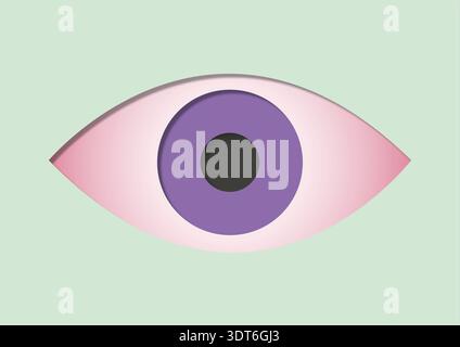 Illustration der Konjunktivitis. Allgemein als rosafarbenes Auge bezeichnet, bei einer Entzündung der klaren Membran, die den weißen Teil des Auges bedeckt. Sie kann durch virale oder bakterielle Infektionen, Allergien oder Reizmittel verursacht werden. Symptome sind rote, juckende und brennende Augen, oft begleitet von übermäßigem Tränen und klebrigem Ausfluss. Das Rosa Auge verschwindet normalerweise innerhalb von ein bis zwei Wochen. Die Behandlung konzentriert sich auf Methoden wie Kältekompressionen, künstliche Tränen und bei bakteriellen Infektionen Antibiotika. Stockfoto