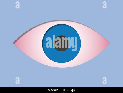Illustration der Konjunktivitis. Allgemein als rosafarbenes Auge bezeichnet, bei einer Entzündung der klaren Membran, die den weißen Teil des Auges bedeckt. Sie kann durch virale oder bakterielle Infektionen, Allergien oder Reizmittel verursacht werden. Symptome sind rote, juckende und brennende Augen, oft begleitet von übermäßigem Tränen und klebrigem Ausfluss. Das Rosa Auge verschwindet normalerweise innerhalb von ein bis zwei Wochen. Die Behandlung konzentriert sich auf Methoden wie Kältekompressionen, künstliche Tränen und bei bakteriellen Infektionen Antibiotika. Stockfoto