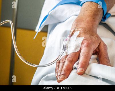 Platzierung einer intravenösen Durchstechflasche (periphere Venenkatheterisierung), Son Llatzer Hospital, Mallorca, Balearen, Spanien. Stockfoto