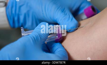 Medizinisches Fachpersonal entnimmt Blut aus dem Arm des Patienten mit einer Nadel und einem Reagenzglas in einer medizinischen Klinik. Stockfoto