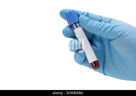 Detailliertes Foto einer blauen Hand mit Handschuhen, die ein Labor-Reagenzglas mit roter Flüssigkeit, helle weiße Beleuchtung und klares Aussehen präsentiert. Stockfoto