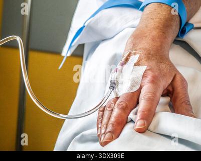 Platzierung einer intravenösen Durchstechflasche (periphere Venenkatheterisierung), Son Llatzer Hospital, Mallorca, Balearen, Spanien Stockfoto