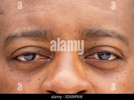 Afrikanischer Mann mittleren Alters, der in extremer Nahaufnahme blickt, Augen mit Hornhautreflexen und Haut zeigt Stockfoto