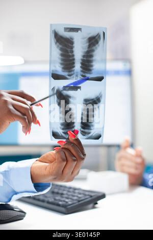 Detailansicht der afroamerikanischen Ärztin, die während des Klinikbesuchs Röntgenaufnahmen hält und Bereiche für kaukasische Patienten aufzeigt. Nahaufnahme einer Röntgenaufnahme, die zur Erläuterung der Diagnoseergebnisse verwendet wird. Stockfoto