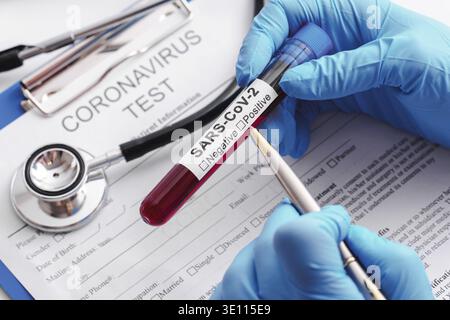 Nahaufnahme der wissenschaftlichen Hand mit einer Blutprobe von SARS-CoV-2 Stockfoto