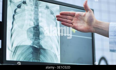 Arzt, der die Röntgenaufnahme des menschlichen Thorax am Monitor für die medizinische Diagnose auswertet Stockfoto
