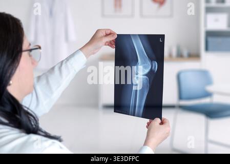 Arzt, der das Röntgenbild des Kniegelenks in der Klinik für orthopädische Diagnostik, Verletzungsbeurteilung und medizinische Bildgebung analysiert Stockfoto