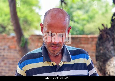 Kaukasier mittleren Alters mit kontemplativem Ausdruck, der ein gestreiftes Poloshirt trägt und draußen in einer ländlichen afrikanischen Gemeinde steht. Stockfoto