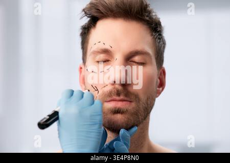 Der plastische Chirurg umreißt das Gesicht des männlichen Patienten vor dem kosmetischen Eingriff Stockfoto