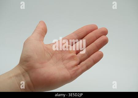 Nahaufnahme der schwieligen Palme eines Mannes. Hochwertige Fotos Stockfoto
