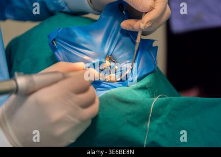 Nahaufnahme zahnärztlicher Eingriff mit Werkzeugen und Schutzfolie Zahnarzthände mit Handschuhen Arbeit am Zahn in der klinischen Umgebung Gesundheitsbehandlung und Stockfoto