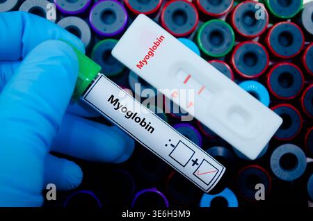 Blutprobe des Patienten-positiven Myoglobinergebnisses. Stockfoto