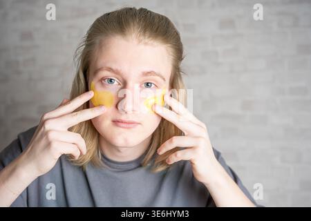 Junger gutaussehender blonder Mann, der gelbe Augenflecken aufträgt, Nahaufnahme Porträt. Beauty-Routine, mit feuchtigkeitsspendenden Gesichtspflecken. Stockfoto
