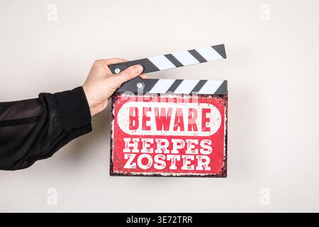 Herpes Zoster-Meldung Auf Rotem Warnschild, Die Von Der Person Angezeigt Wird Stockfoto