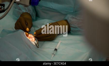 Nahaufnahme der Hände eines Chirurgen, die komplizierte Mikrochirurgie am Auge eines Patienten durchführen. Präzisionsinstrumente werden in einem sterilen Operationssaal verwendet Stockfoto