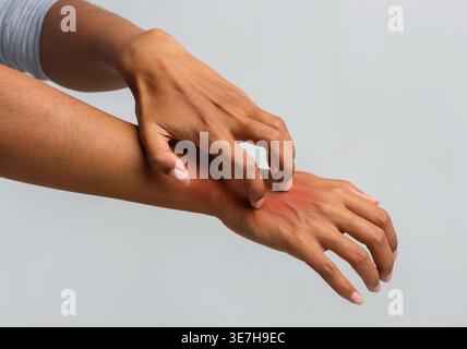 Schwarze Frau, die an Psoriasis leidet, kratzt ihre Hand vor grauem Hintergrund im Atelier Stockfoto