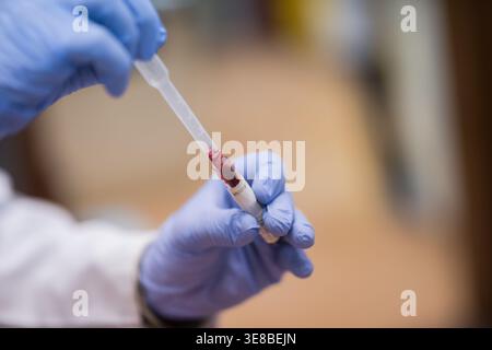 Medizintechniker, der Blutproben mit Pipette im klinischen Labor für diagnostische Tests handhabt Stockfoto