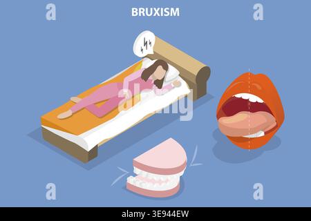 3D Isometrischer Flachvektor konzeptuelle Darstellung von Bruxismus, Zahnschleifen Stockfoto