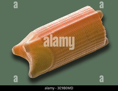 Kieselalgen. Farbige Rasterelektronenmikrographie (REM). Vergrößerung: x2000 bei Druck in einer Breite von 10 Zentimetern. Stockfoto