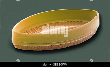 Kieselalgen. Farbige Rasterelektronenmikrographie (REM)-Kieselalgen. Vergrößerung: x2000 bei Druck in einer Breite von 10 Zentimetern. Stockfoto