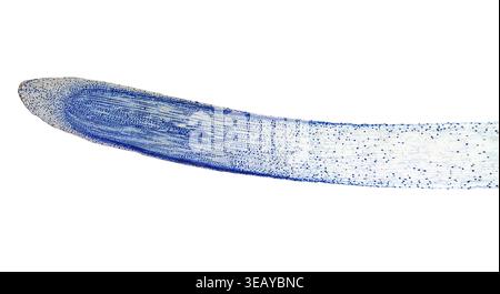 Leichte Mikrophotographie der Mitose der Zwiebel Tipp Wurzelzellen durch Mikroskop gesehen Stockfoto