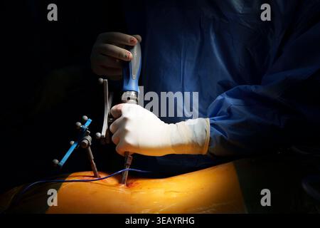 Chirurg, der eine präzise Wirbelsäulenchirurgie mit Navigations-Tracking-Instrumenten im Operationssaal durchführt Stockfoto