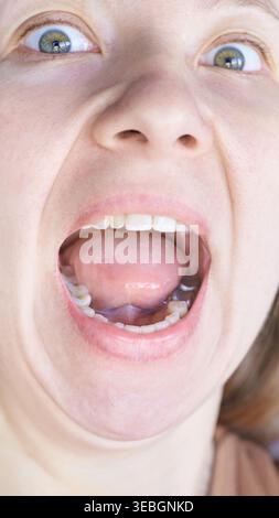 Vertikale Nahaufnahme Erwachsene, Weiblich, Die Mund Breit Öffnet, Mit Sichtbaren Zunge Und Augen, Die Vor Einem Normalen Hintergrund Geweitet Sind Und Intensive Emotionale Ausdrücke Erfassen. Stockfoto