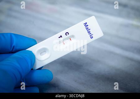 Blutprobe eines Patienten-positiven Malariaergebnisses. Stockfoto