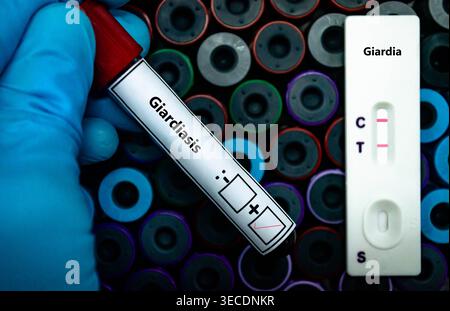 Blutprobe des Patienten-positiven Befundes bei Giardiasis. Stockfoto