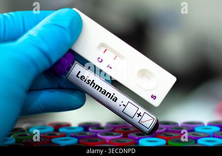 Blutprobe eines Patienten-positiven Leishmanie-Ergebnisses. Stockfoto