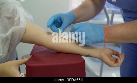 Medizinisches Fachpersonal, das einen intravenösen Katheter in den Arm eines Patienten einführt, um Flüssigkeiten oder Medikamente zu verabreichen Stockfoto