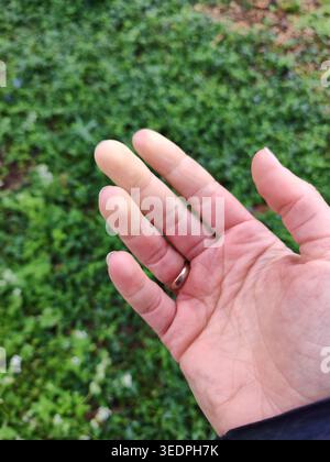Morbus Raynaud (Syndrom). Hände einer jungen Frau, die an raynauds Phänomen leidet. Grüner Hintergrund. Sklerodermie Stockfoto