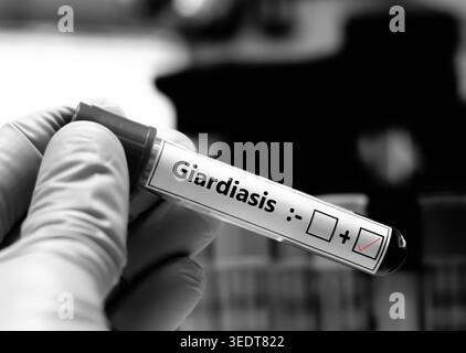 Blutprobe des Patienten-positiven Befundes bei Giardiasis. Stockfoto