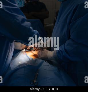 Fokussierter Schuss von Chirurgenhänden in sterilen Handschuhen bei einem Eingriff unter hellem Operationslicht. Medizinisches Team arbeitet in einer dunklen OP zusammen Stockfoto