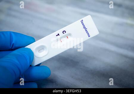 Blutprobe eines Patienten-positiven Toxoplasma-Ergebnisses. Stockfoto