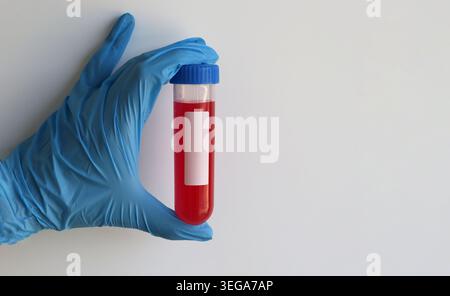 Handschuh-Handteströhrchen für Hantavirus-Nachweis und Infektionskrankheitsdiagnostik. Medizinisches Versorgungskonzept für die Virusforschung und Stockfoto