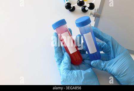 Hände mit Handschuhen, die Laborprobenröhrchen mit farbiger Flüssigkeit für die Virusdiagnostik, chemische Analyse und biologische Forschung halten. Medizinische Versorgung Stockfoto