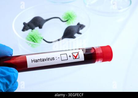 Hantavirus-Blutteströhrchen in Handhaltung mit positivem Ergebnis Stockfoto