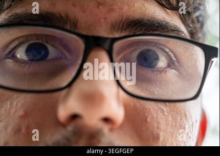 Junger Mann, der eine schwarze Brille trägt und direkt in die Kamera blickt, zeigt einen Blick mit weiten Augen und detaillierte Gesichtszüge mit sichtbaren Poren Stockfoto