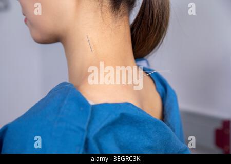 Eine Frau bekommt Akupunktur am Hals in einer medizinischen Umgebung. Stockfoto