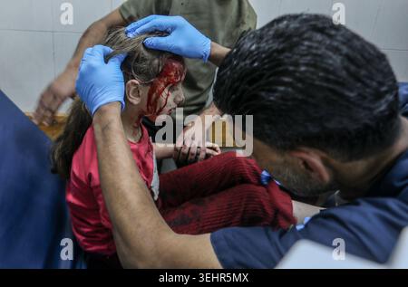 Khan Yunis, Palästinensische Gebiete. Mai 2026. Ein verwundetes Mädchen wird im Nasser Krankenhaus behandelt, nachdem ein israelischer Luftangriff auf ein Zelt in der Nähe des Al-Ribat College abzielte. Quelle: Abed Rahim Khatib/dpa – AUFMERKSAMKEIT: Grafikinhalte/dpa/Alamy Live News Stockfoto