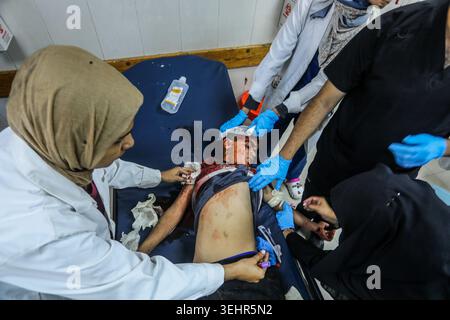 Khan Yunis, Palästinensische Gebiete. Mai 2026. Ein verwundetes Mädchen wird im Nasser Krankenhaus behandelt, nachdem ein israelischer Luftangriff auf ein Zelt in der Nähe des Al-Ribat College abzielte. Quelle: Abed Rahim Khatib/dpa – AUFMERKSAMKEIT: Grafikinhalte/dpa/Alamy Live News Stockfoto