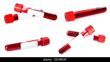 Reagenzgläser mit Blutproben isoliert auf weiß, Set Stockfoto